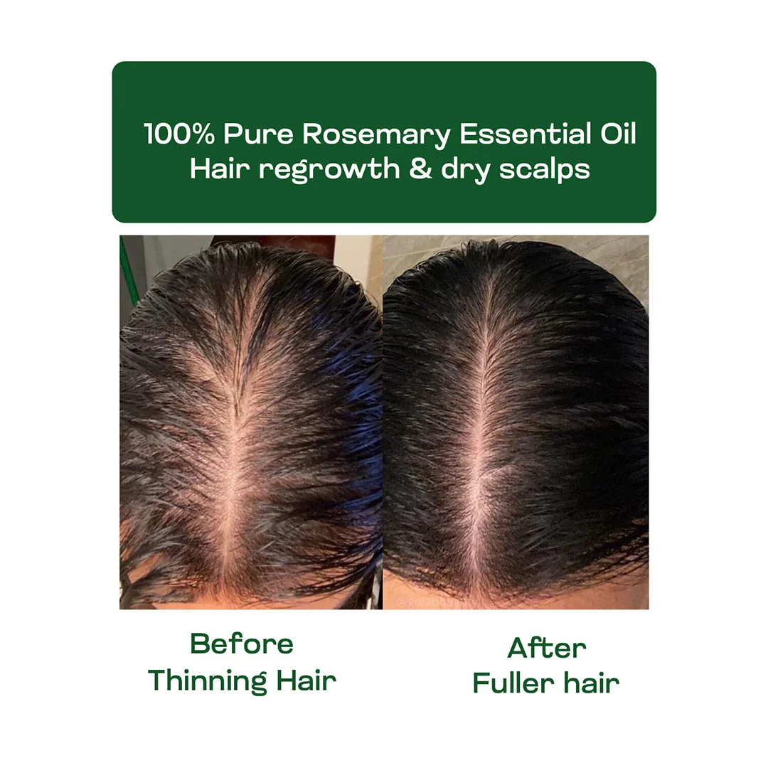 Rosemary Essential Oil 10ml - Image 7