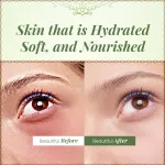 Pure Aloe Vera Gel - 100gm — View 3