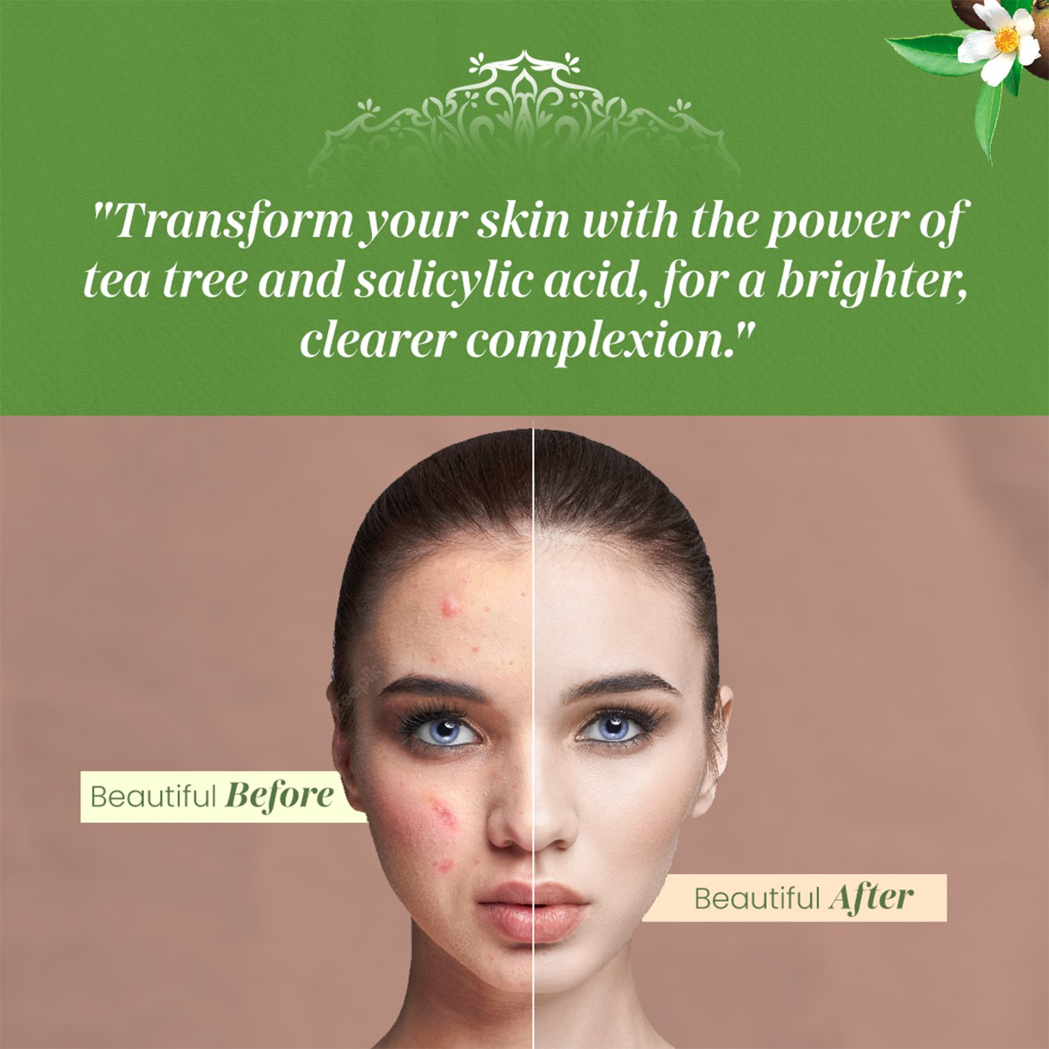 Tea Tree &amp;amp;amp; Salicylic Acid Face Serum - 30ml — View 3